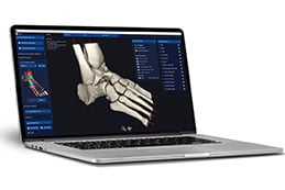 Laptop with Disior foot imaging software
